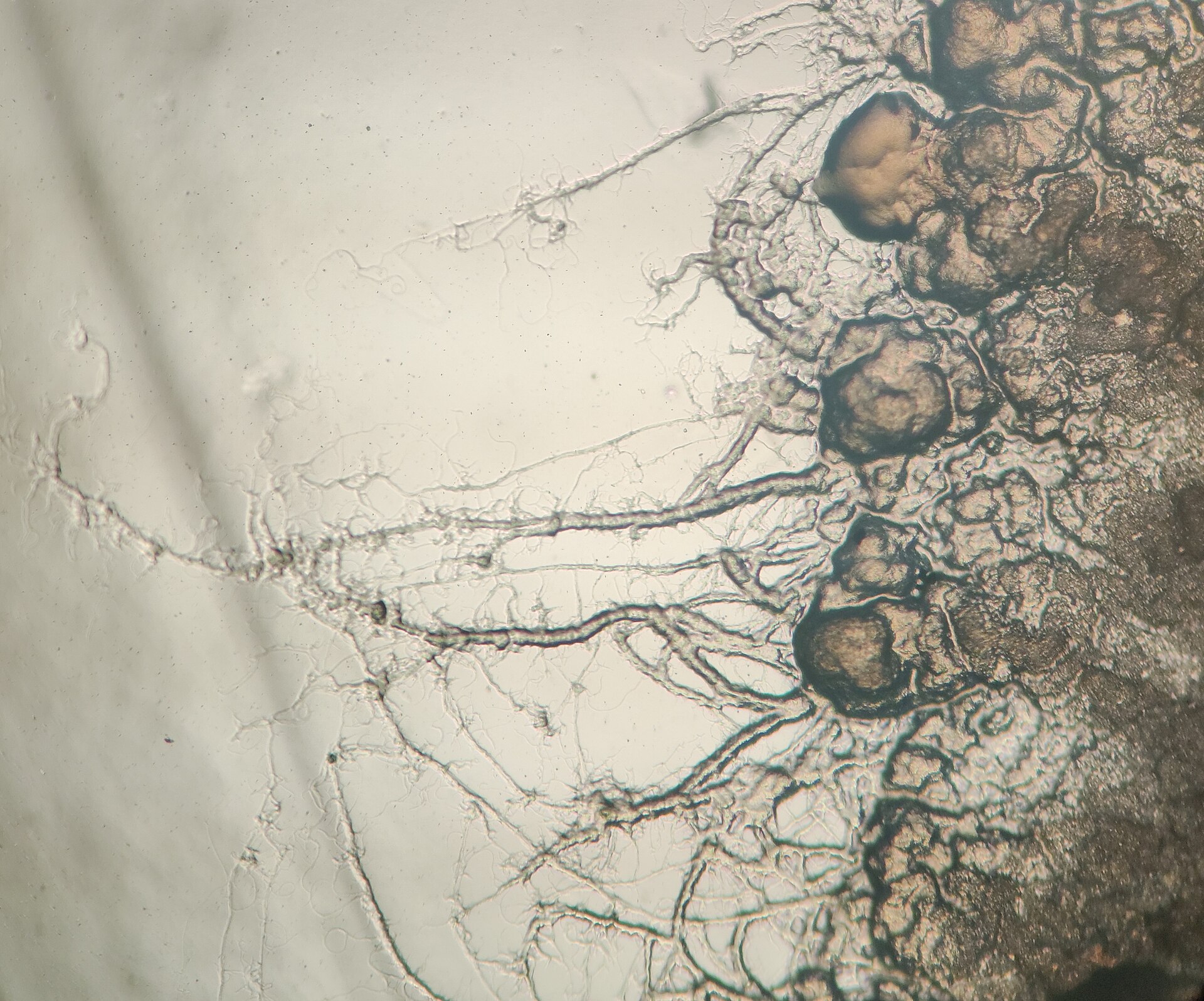 Бактеріальні колонії під мікроскопом / Bacterial colonies under a microscope.