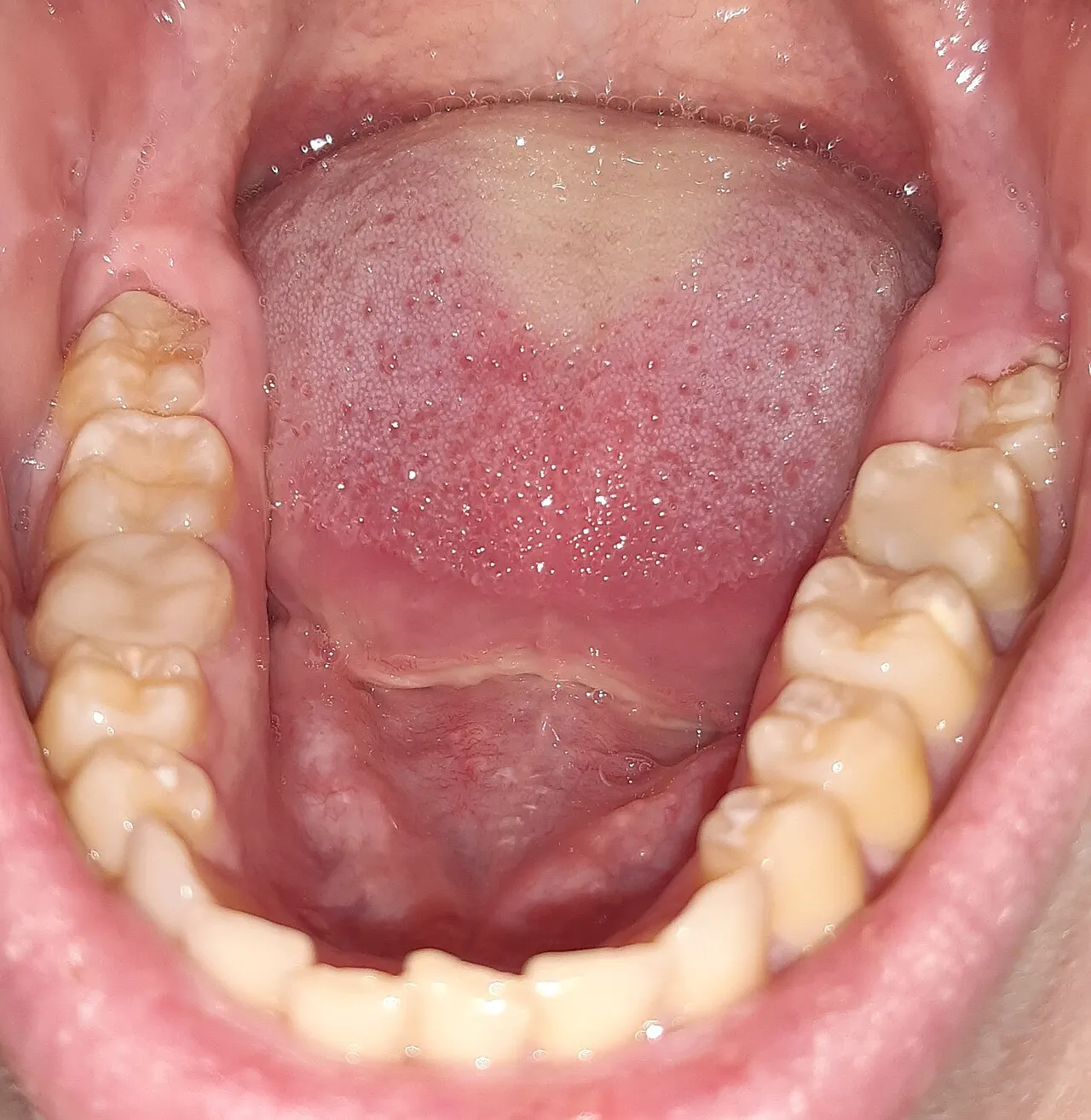 close photograph of an open human mouth and teeth; contextual, not Vijay Kumar. Alina Youshko, Wikimedia Commons, https://commons.wikimedia.org/wiki/File:Open_mouth.jpg, CC BY 4.0 (https://creativecommons.org/licenses/by/4.0/). Attribution: Alina Youshko, “Open mouth,” CC BY 4.0, via Wikimedia Commons. Downloaded resized variant (`?width=1200`); checked 2026-10-18.