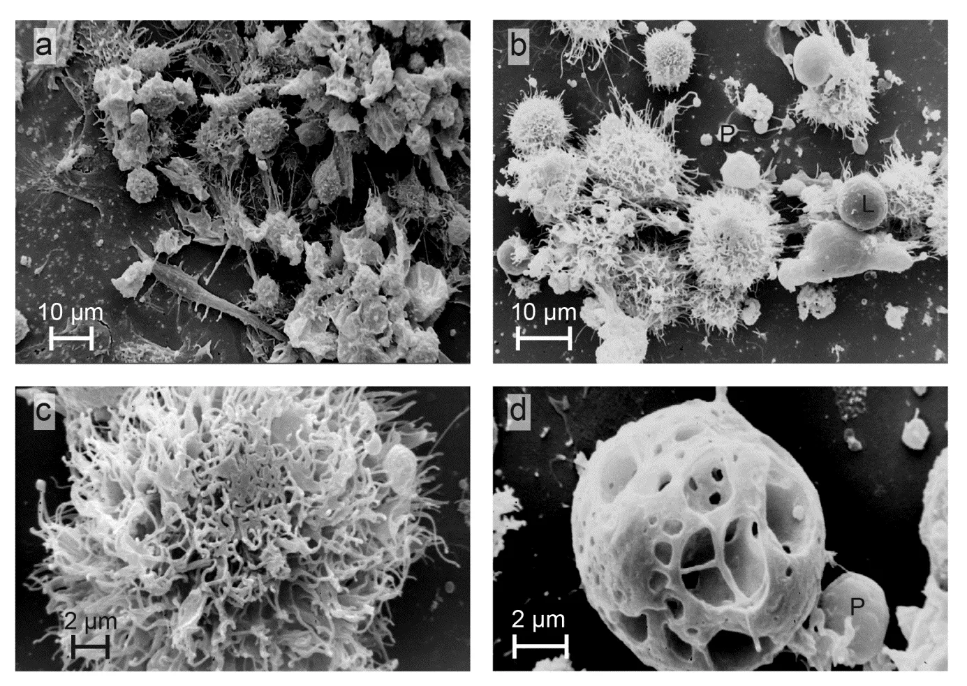 Scanning electron micrographs of cultured mature myeloid dendritic cells, with 10 μm and 2 μm scale bars. Authors Josef Neumüller, Sylvia Emanuela Neumüller-Guber, Johannes Huber, Adolf Ellinger and Thomas Wagner. Wikimedia Commons: https://commons.wikimedia.org/wiki/File:Mature_myeloid_dendritic_cells.png; CC BY-SA 3.0, attribution and ShareAlike apply. Illustrates cell morphology only; it is not a Steinman experiment or historical image from his paper. Copied unchanged; 19 October 2026.