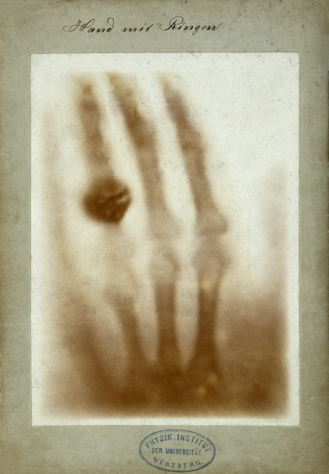 оптимізовано з `media/first-medical-xray-hand.jpg`: 1696×2438 px (половина початкової ширини й висоти), JPEG quality 82.