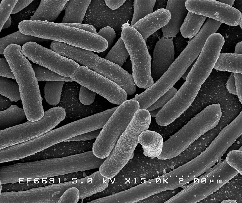 Реальна сканувальна електронна мікрофотографія E. coli, NIAID; контекст бактерій, не зразок мишачої мікробіоти досліду / Actual NIAID scanning electron micrograph of E. coli; bacterial context, not a mouse-microbiota sample from the study.