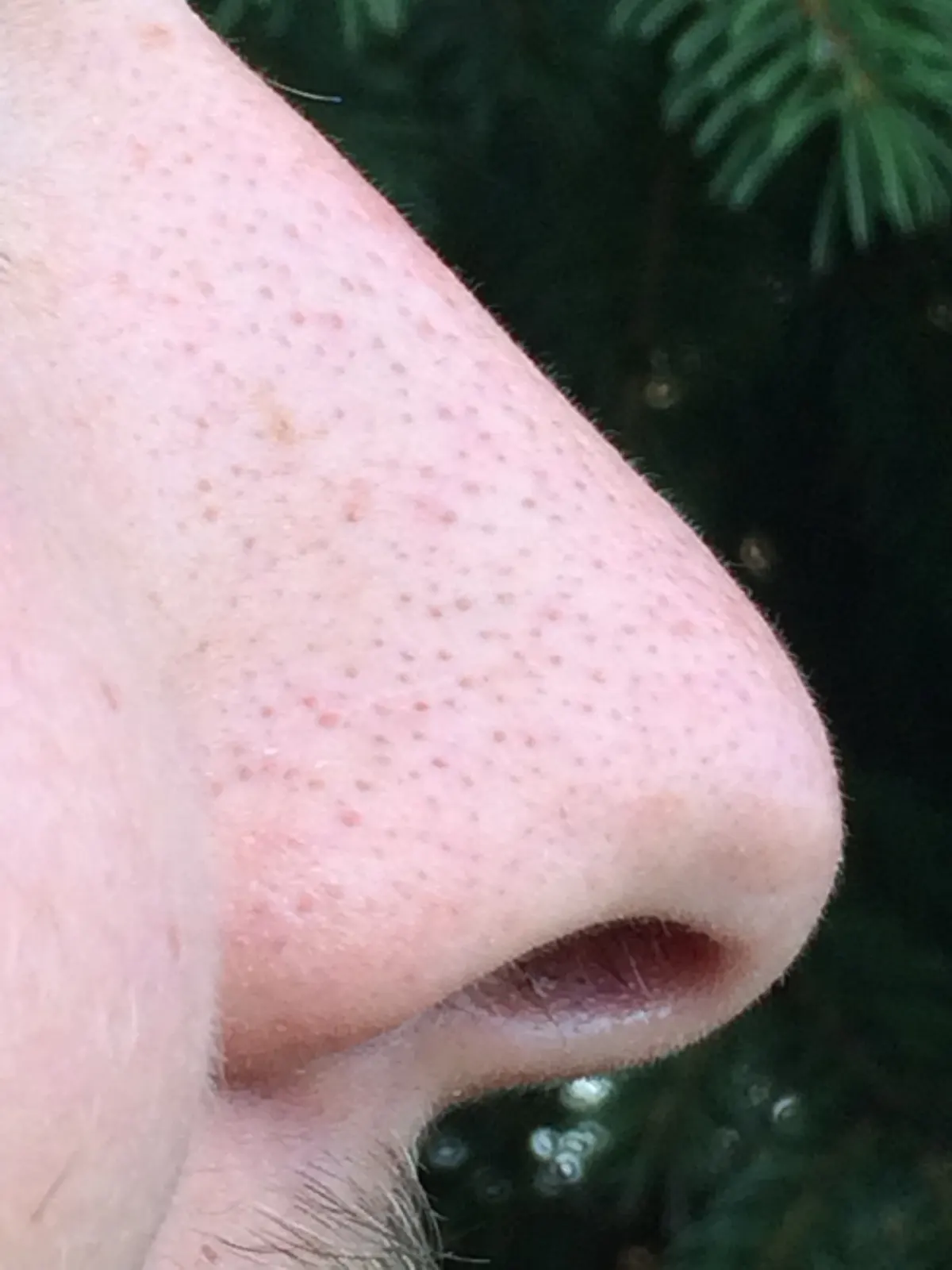 documentary close-up photograph of an unidentified person’s nose in profile; not Bashaw or the record attempt. Original page: https://commons.wikimedia.org/wiki/File:Nose_Example.jpg. Creator TheNoseKnows2Much. CC BY-SA 4.0 (https://creativecommons.org/licenses/by-sa/4.0/). Attribution: TheNoseKnows2Much, “Nose Example,” CC BY-SA 4.0, via Wikimedia Commons. Original JPEG, unchanged.