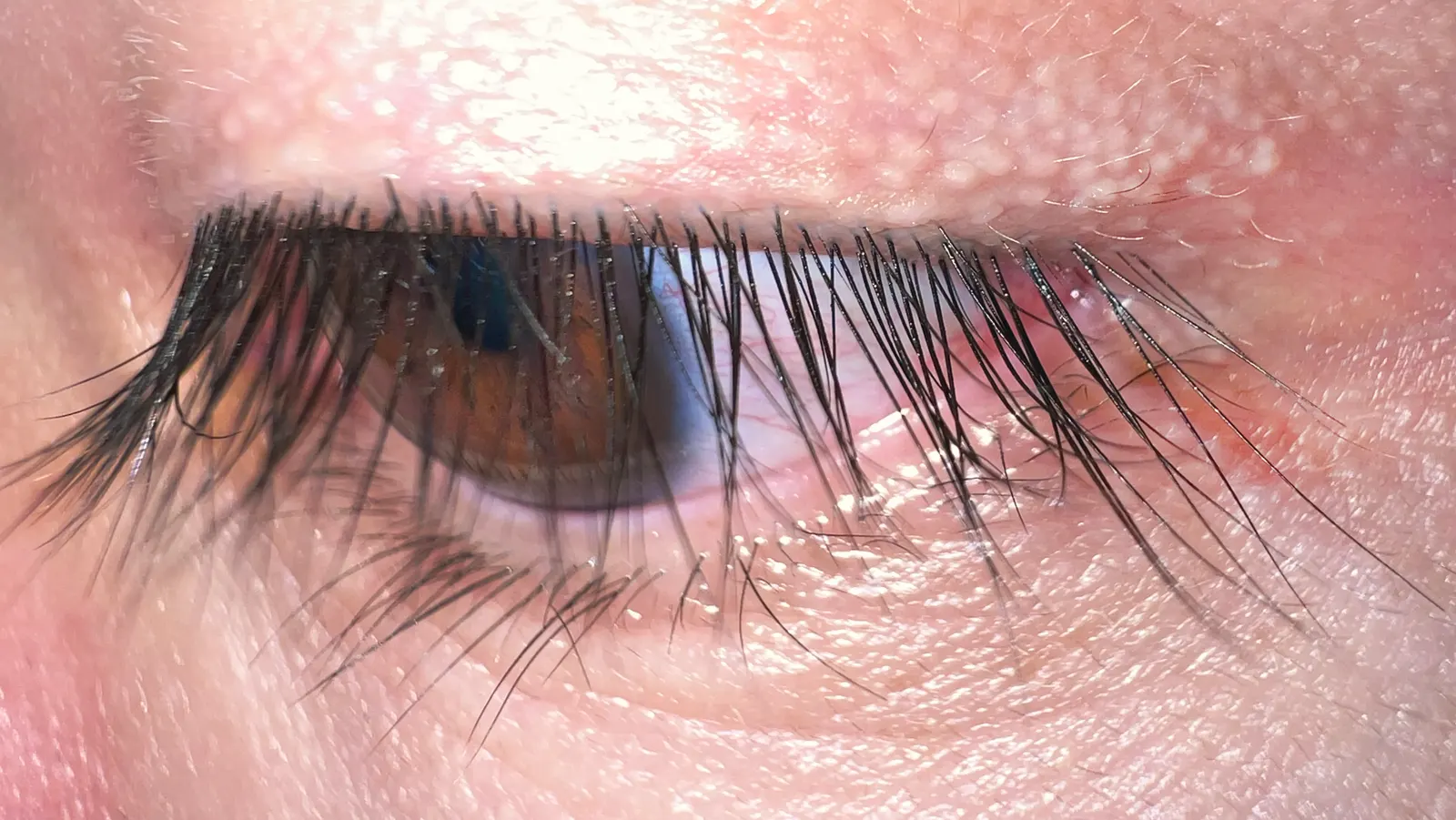 close-up of upper and lower eyelid lashes on an Asian male; contextual and not You Jianxia. Photographer Rapidreflex, Wikimedia Commons, https://commons.wikimedia.org/wiki/File:Human_eyelashes.jpg; CC BY-SA 4.0 (https://creativecommons.org/licenses/by-sa/4.0/). Attribution: Rapidreflex, “Human eyelashes,” CC BY-SA 4.0, via Wikimedia Commons. Original file, no edits; checked 2026-10-18.