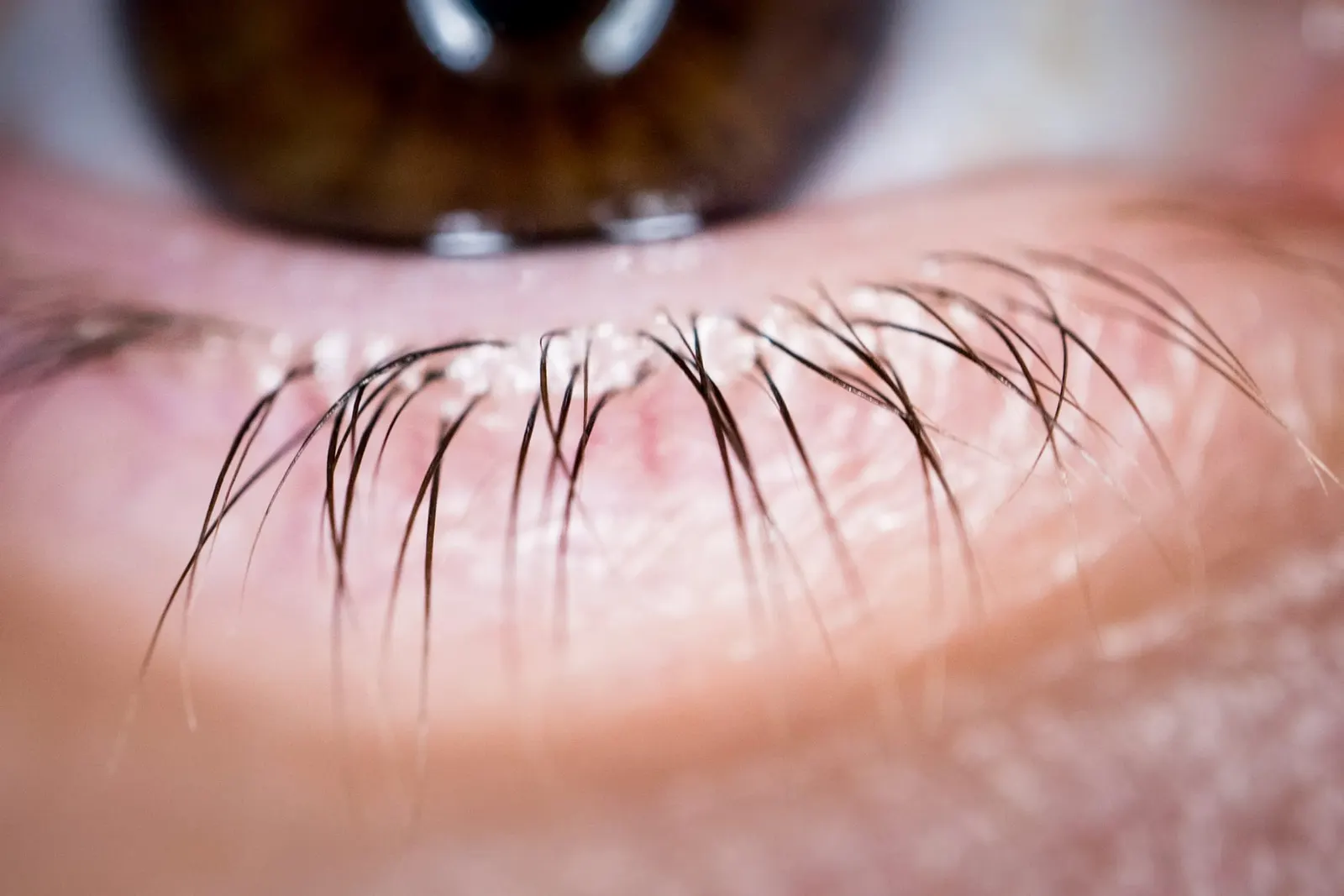 оптимізовано з `media/human-eyelashes-closeup-ivan-radic.jpg`: 1844×1230 px (половина початкової ширини й висоти), JPEG quality 82.