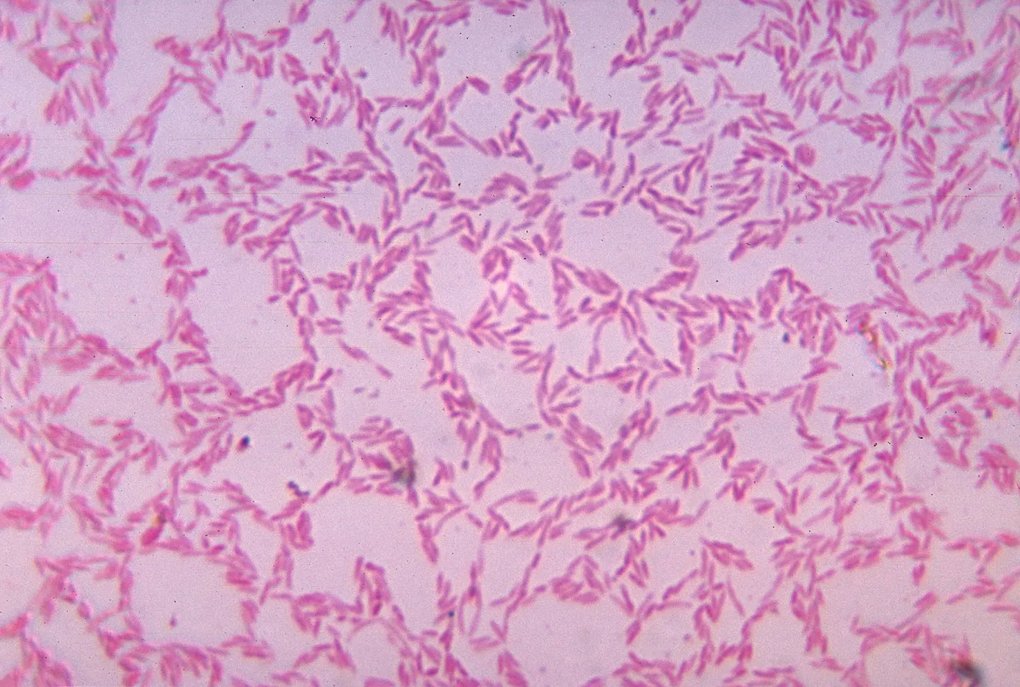 culture of *Bacteroides biacutis*, a representative gut anaerobe, grown on blood agar. Source: https://commons.wikimedia.org/wiki/File:Bacteroides_biacutis_01.jpg ; CDC Public Health Image Library #3087: https://phil.cdc.gov/Details.aspx?pid=3087 . Credit CDC / Dr. V. R. Dowell, Jr.; U.S. federal work, public domain in the United States. No edits. Copied from fact 046; checked 2026-10-21.
